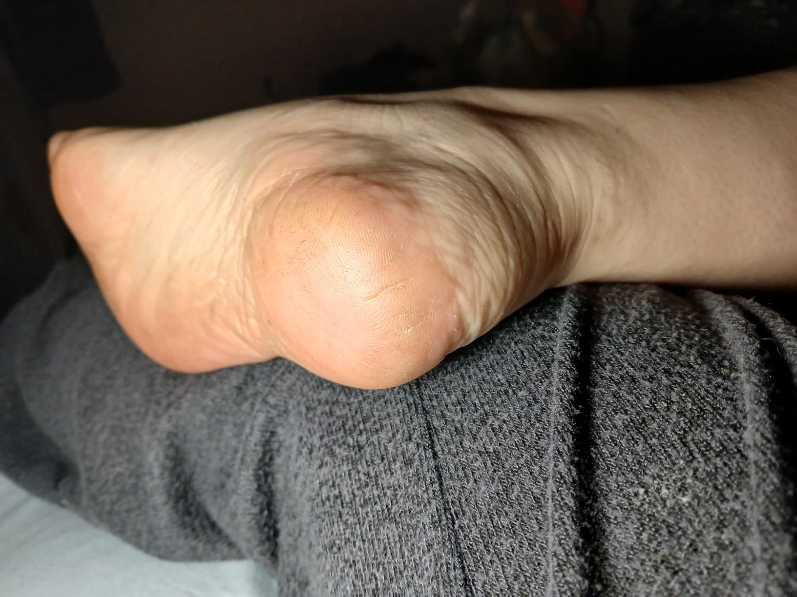 O'Keeffe's for Healthy Feet Foot Cream - 3.2 oz Jar (1 Pack) - Guaranteed Relief for Extremely Cracked, Dry Feet, Repairing Skincare, Instantly Boosts and Retains Moisture Levels customer photo 1