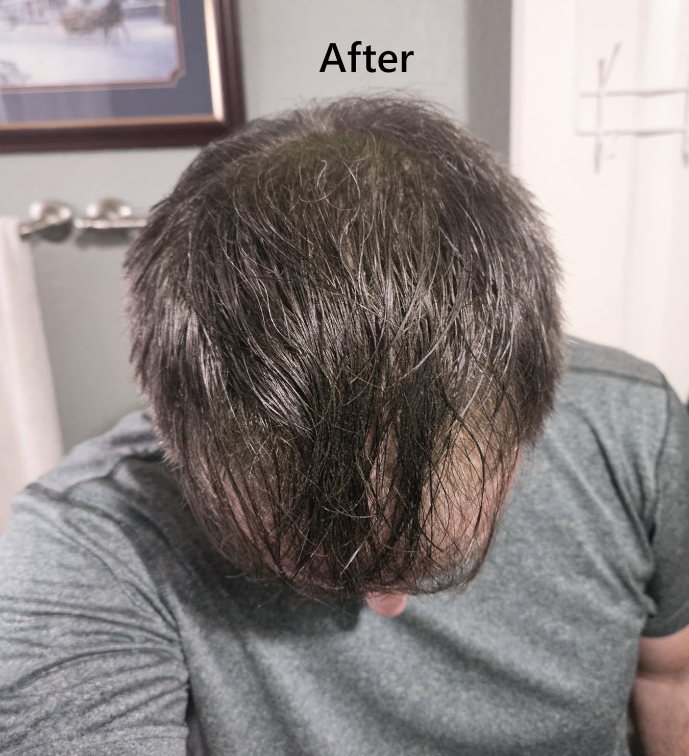 Toppik Hair Building Fibers, Fill In Fine or Thinning Hair Instantly Thicker, Fuller Looking Hair customer photo 1