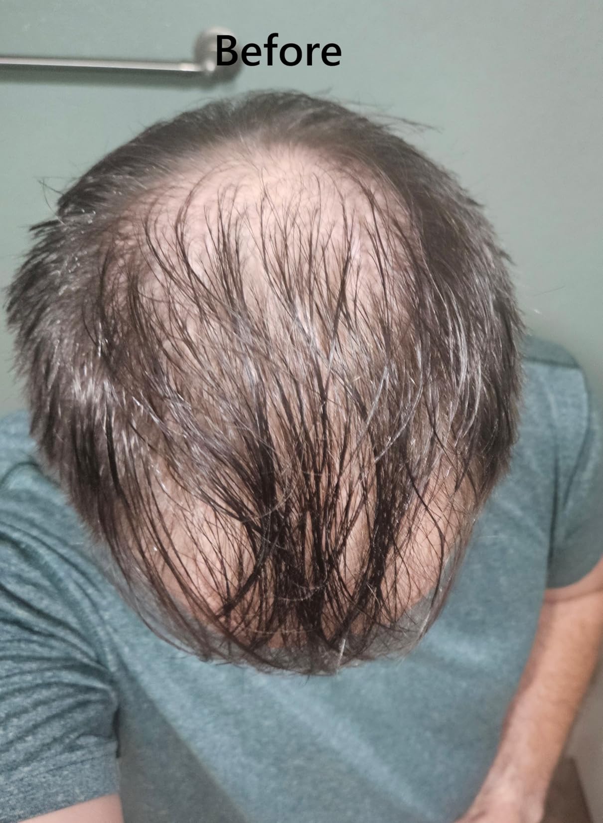 Toppik Hair Building Fibers, Fill In Fine or Thinning Hair Instantly Thicker, Fuller Looking Hair customer photo 2
