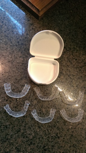 Professional Custom Teeth Whitening Tray Kit - Dental Lab Direct, Custom Made with 38% High Intensity Gel customer photo 1