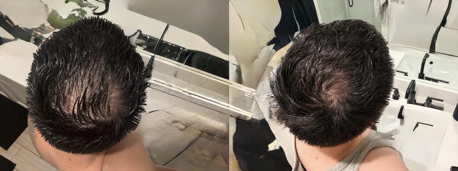 iRestore Essential - Laser Red Light Therapy for Hair Growth - FDA Cleared Hair Loss, Hair Thinning & Alopecia Treatment for Men & Women - Laser Cap for Hair Regrowth Stimulate Denser Fuller Hair customer photo 1