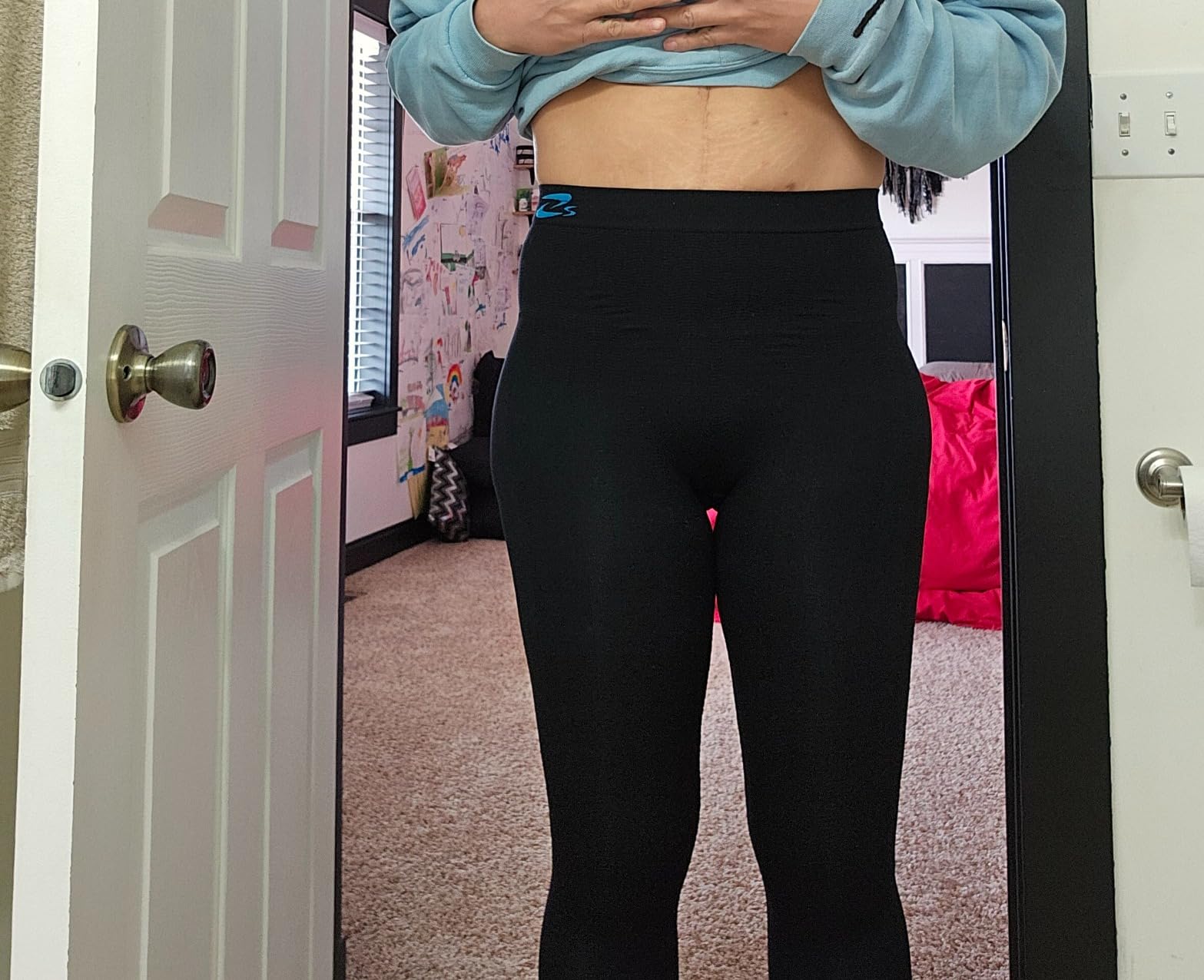 CzSalus Flat Knit K2 Lipedema Lymphedema, POTS Support high Compression Leggins (K2=25-30 mmHg) customer photo 1