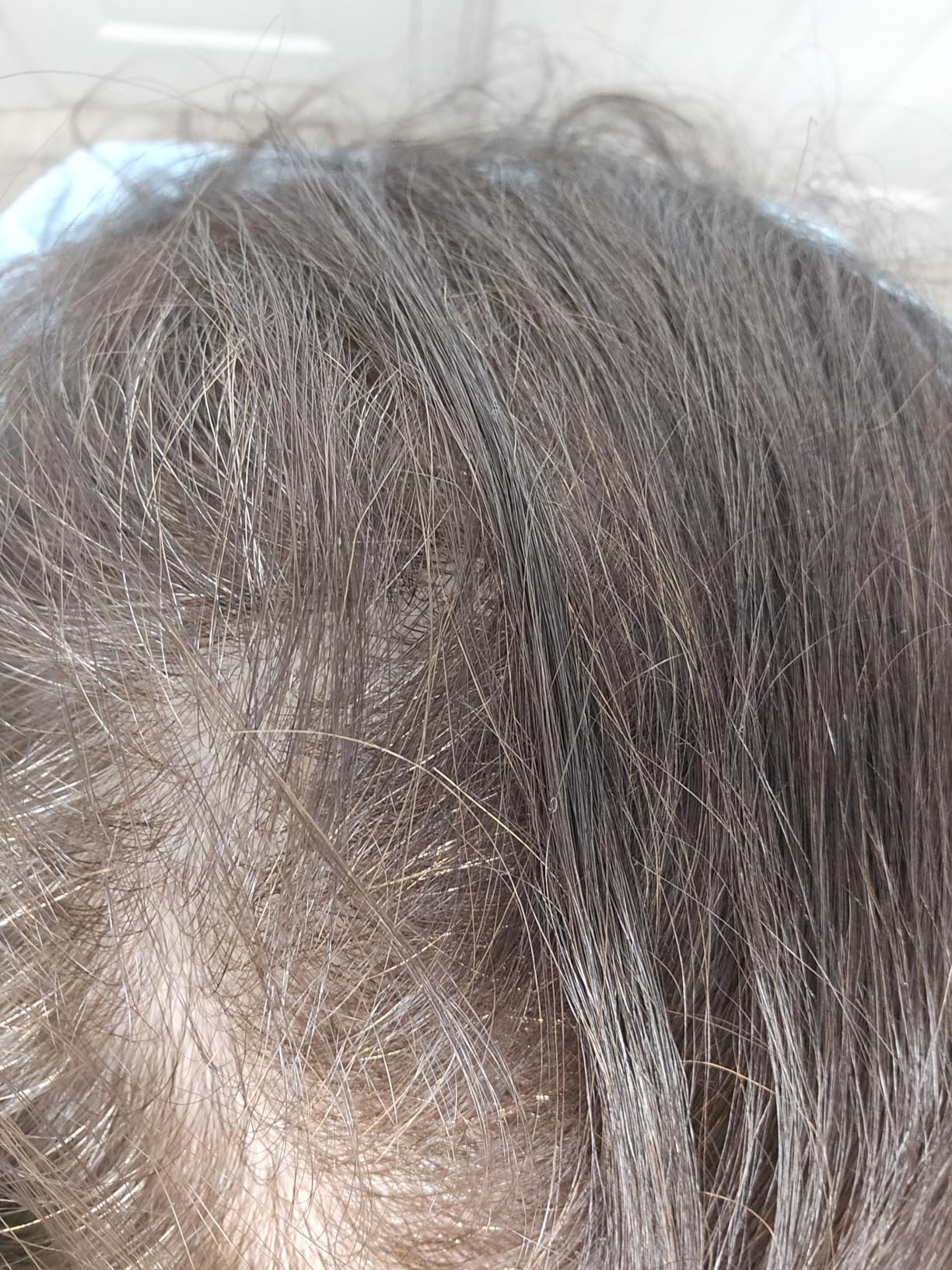 ELEVATE Hair Fibers to Instantly Thicken & Completely Conceal Thinning Balding Areas Loss in 30 Seconds for Men & Women (BLACK) 28g Size - 100% Natural & Undetectable Keratin Fibers customer photo 2