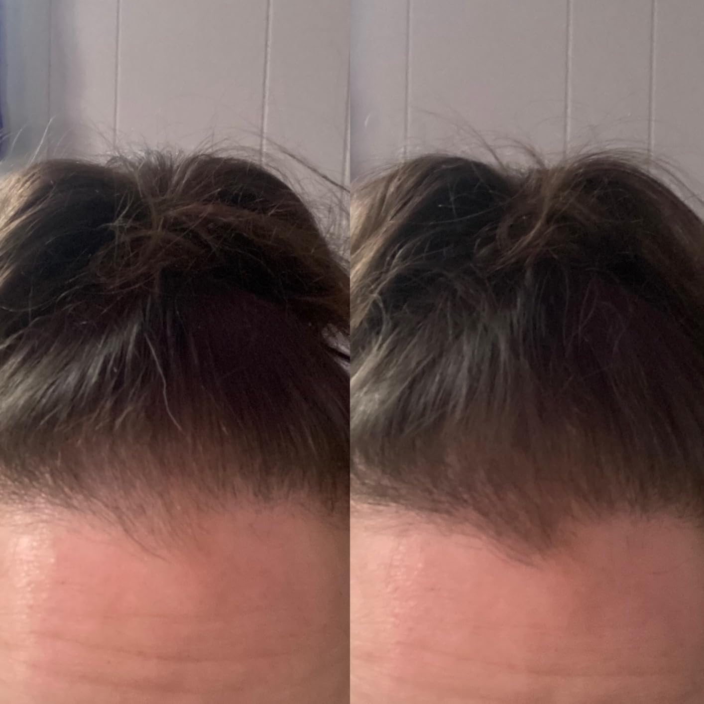 Sevich Hairline Powder,Instantly Conceals Hair Loss, Root Touch up Powder, Hair Shadow Toppers for Women & Men, Touch Up for Thinning Gray Hair, Windproof & Sweatproof,Medium brown customer photo 1