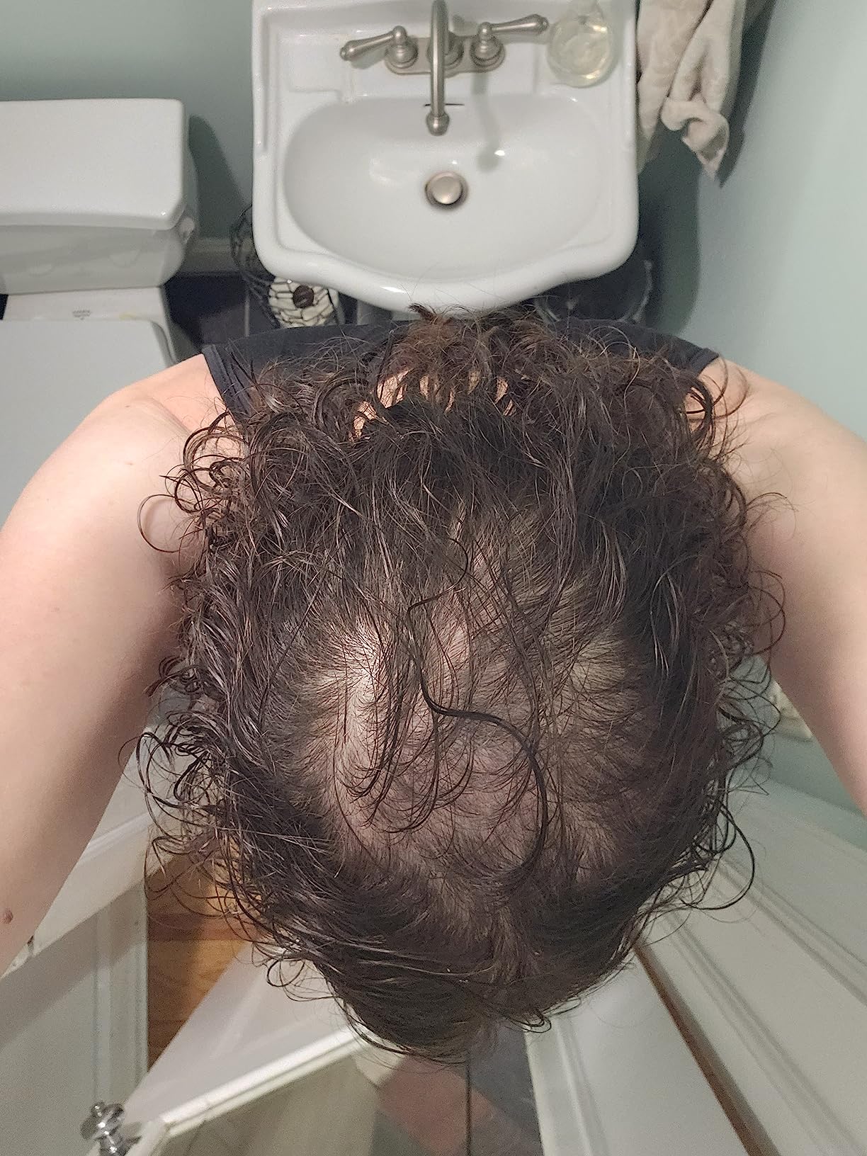 Hair Building Fibers 100 Grams (3.5 oz) Minute Hair Refill Hair Loss Concealer That You Can Use for Your Bottles From Competitors Like Toppik, Xfusion (Dark Brown) customer photo 2