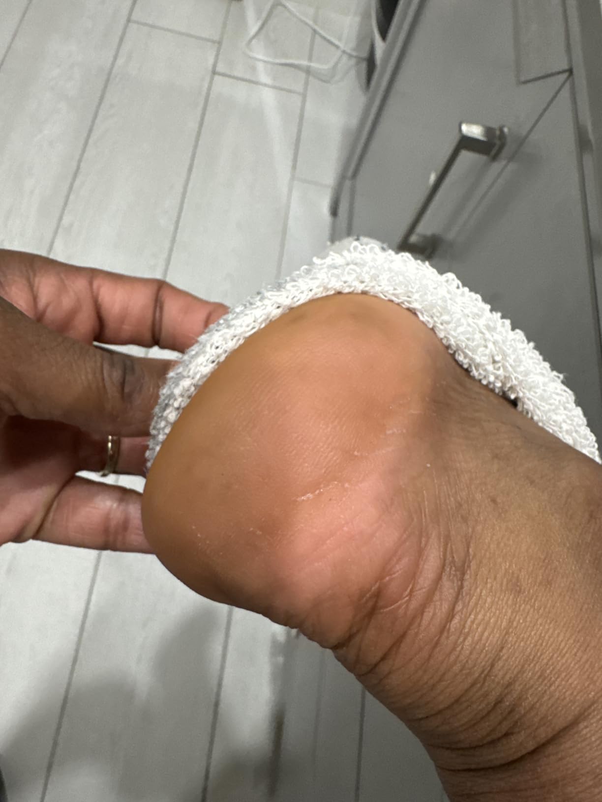 Ebanel Urea Cream 40% plus Salicylic Acid 2%, Foot Cream for Dry Cracked Heels Feet Knees Elbows Hands, Foot Dead Skin Cuticle Callus Remover Toenail Softener, Keratolytic Skin Barrier Repair customer photo 2