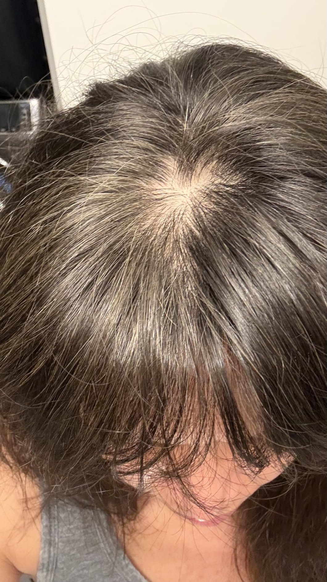 BOLDIFY Hair Fibers (12g) - Fill In Thinning and Fine Hair for an Instantly Fuller, Thicker Look customer photo 1