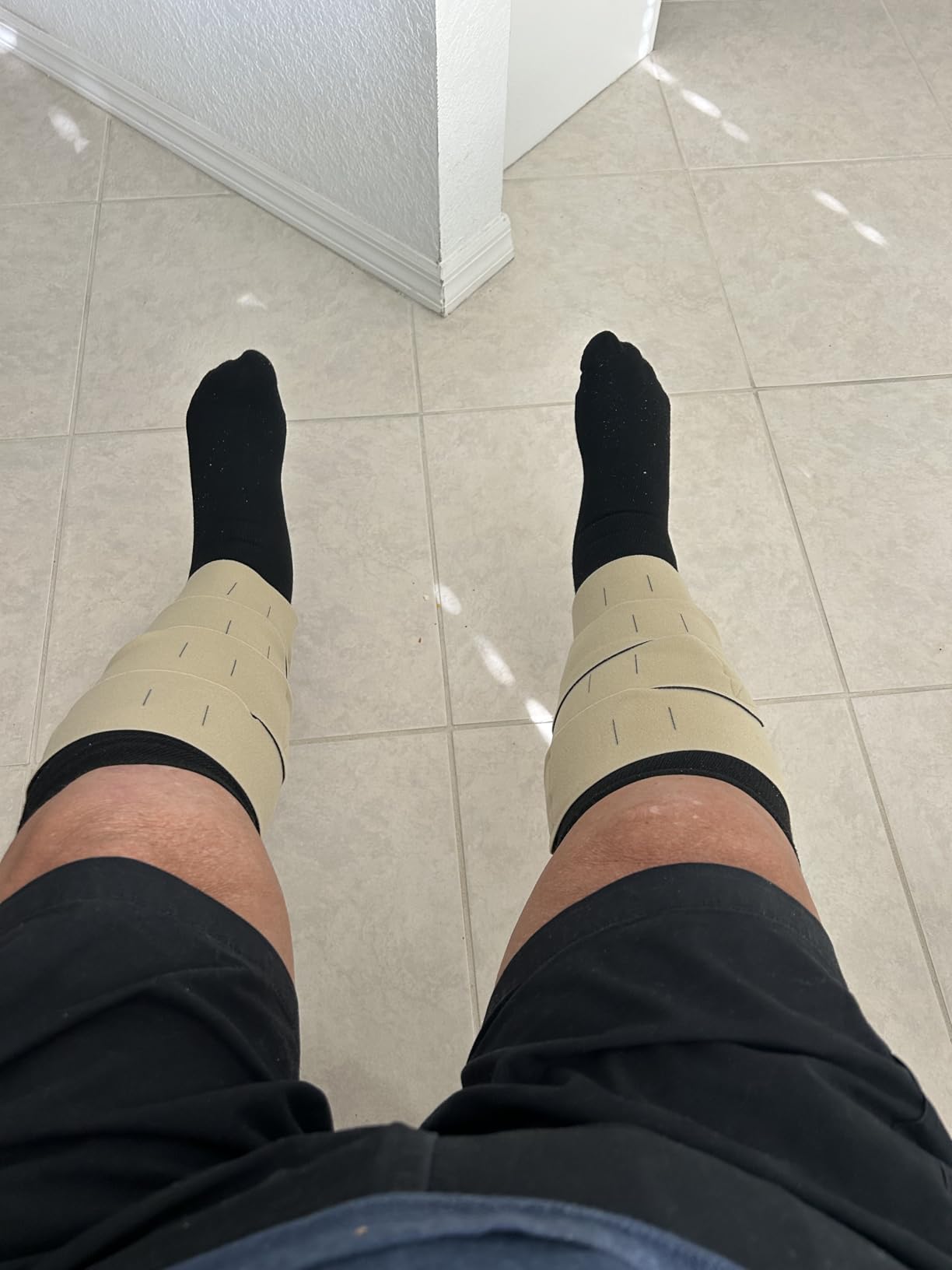 CircAid Juxtalite Lower Leg System - Easy to Use Adjustable Compression Level Garment for Men & Women, Leg Circulation, Compatible with Elastic Stockings , Large / Long customer photo 1