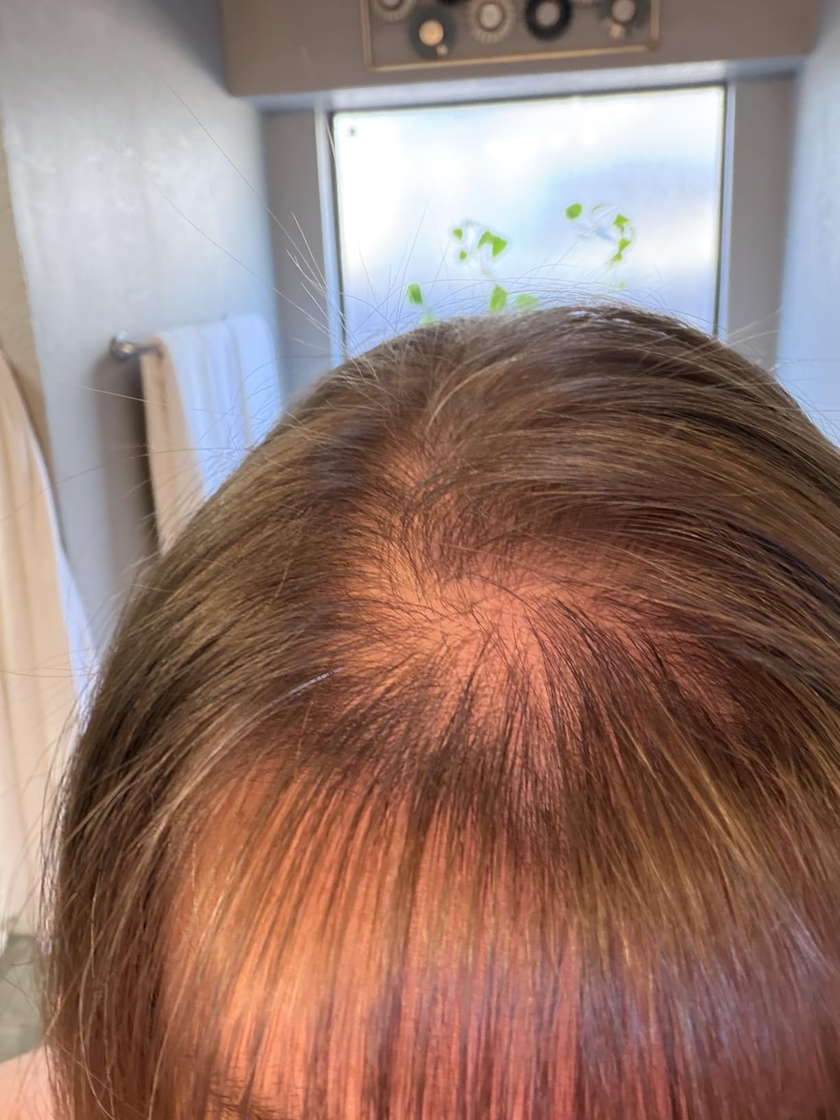 BOLDIFY Hairline Powder - Root Touch Up Hair Color for Gray Coverage - Bald Spot Concealing Hair Powder for Women & Men customer photo 2