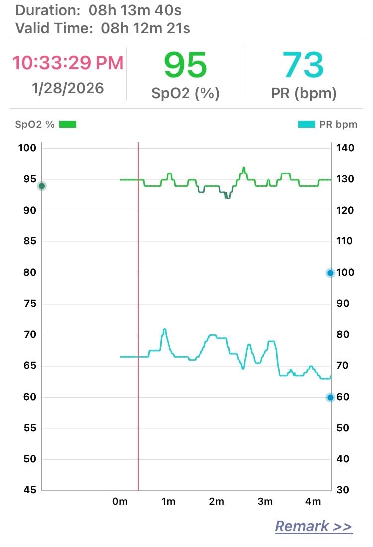 SleepO2 Wrist Recording Pulse Oximeter by EMAY | Continuous Pulse Oximeter to Record Blood Oxygen Saturation and Pulse Rate Overnight | Export Sleep Report & Raw Data customer photo 1