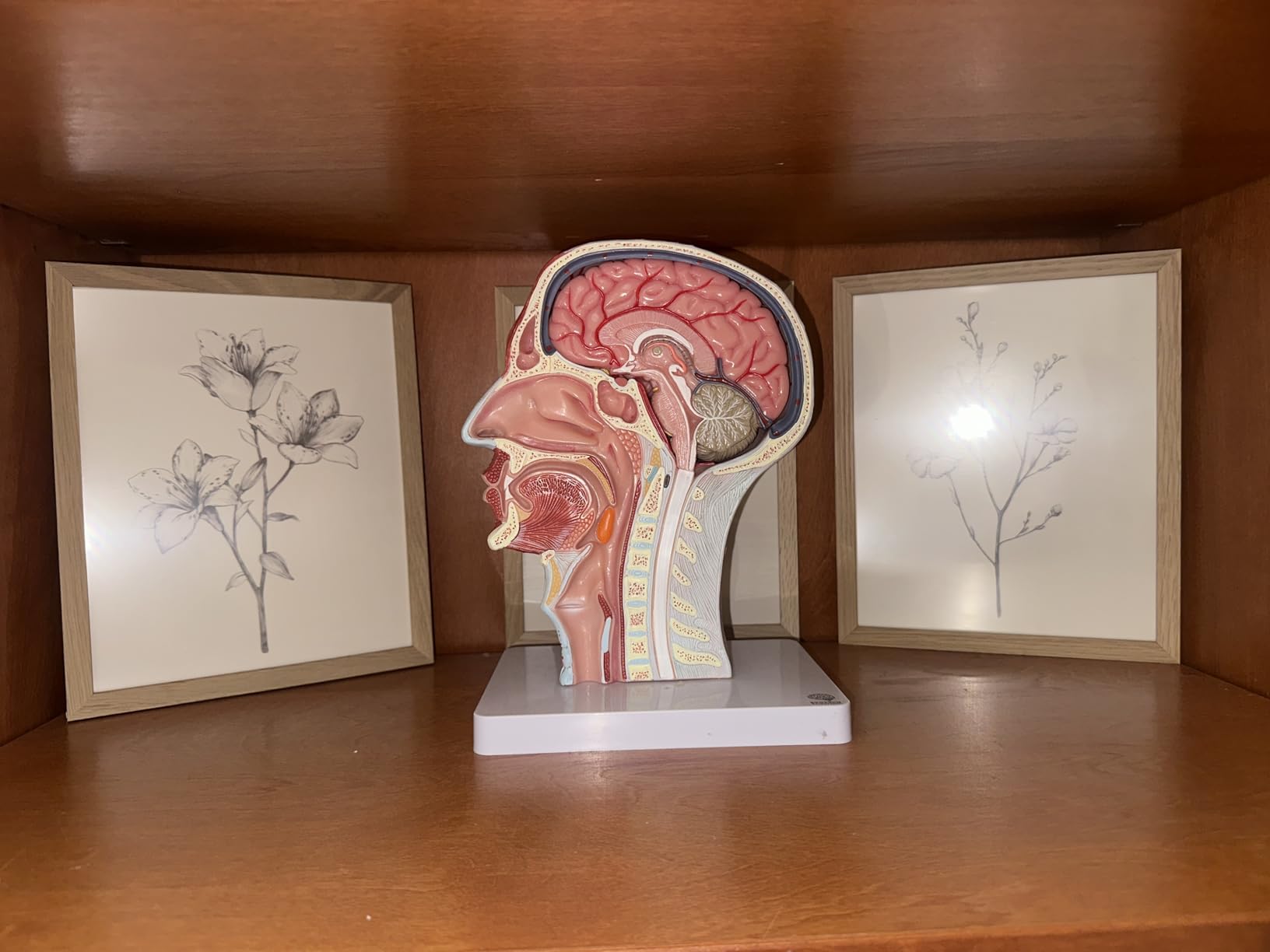 EVOTECH SCIENTIFIC Human Half Head Superficial Neurovascular Musculature Model with Removable Brain, Shows Cranial Cavity Nerve Life Size Anatomical Head Model for Medical Teaching Learning Education customer photo 2