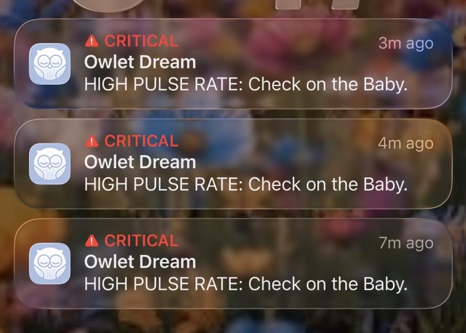 Owlet Dream Duo (Gen 2) Smart Baby Monitor Bundle - HD Video Camera + Wearable Sock Tracks Baby's Oxygen, Heart Rate & Sleep customer photo 1