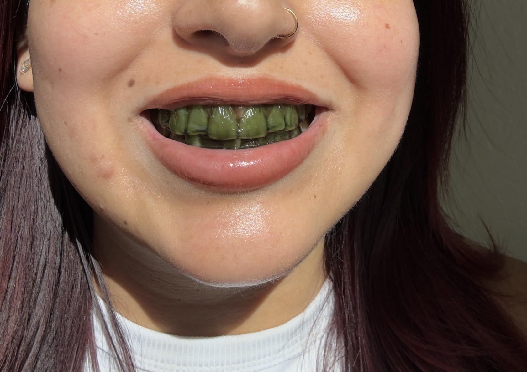 InoPro Teeth Whitening Strips 14 Treatments Kit - Enamel Safe Teeth Whitener, Peroxide-Free, Green White Strips for Teeth Whitening with Arbutin, Coconut Oil, Deep Stains Removal (28 Strips) customer photo 1
