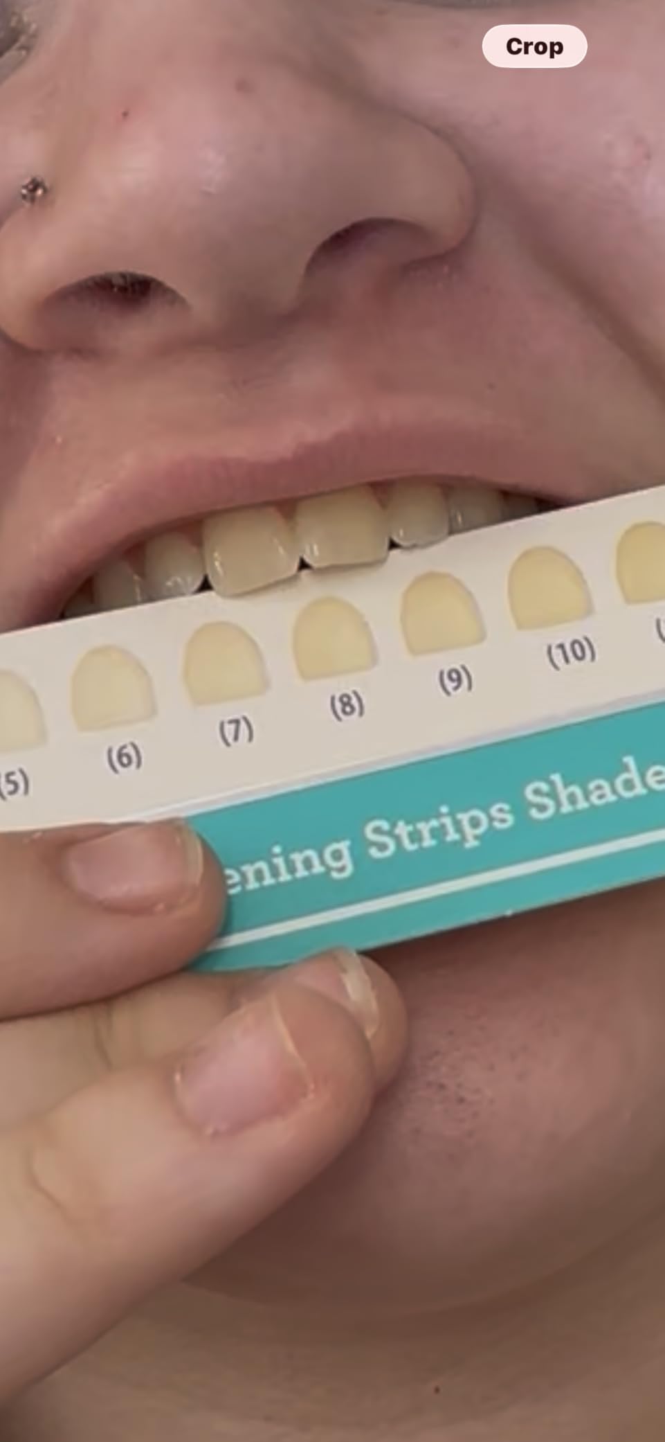 GuruNanda Teeth Whitening Strips - 7-Day Treatment with Non-Slip, Dry Strip Technology - Whitening Designed with Care for a Brighter Smile customer photo 2