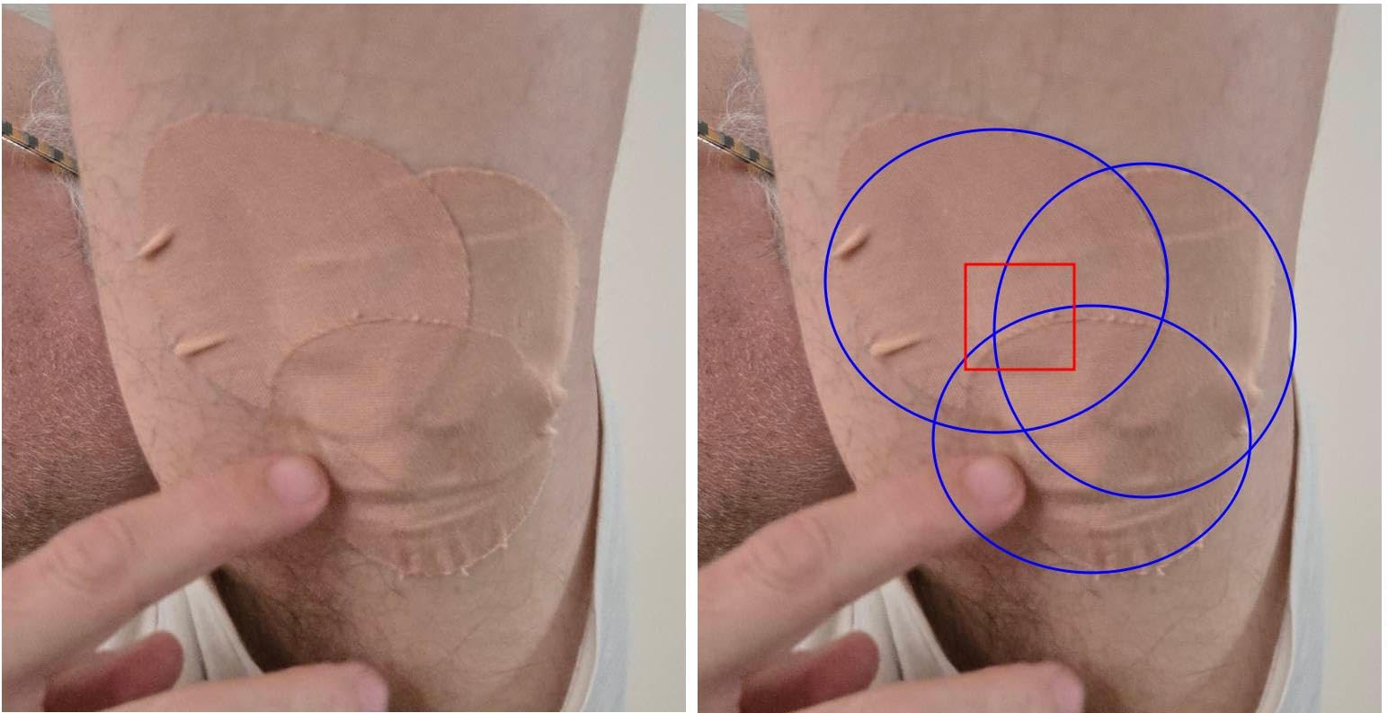 Skin Grip Adhesive Patches Compatible with Dexcom G7 & Stelo CGM - Waterproof & Sweatproof Cover for Continuous Glucose Monitor Sensor, Stays Secure for 10-15 Days - 20 Pack, Tan customer photo 1