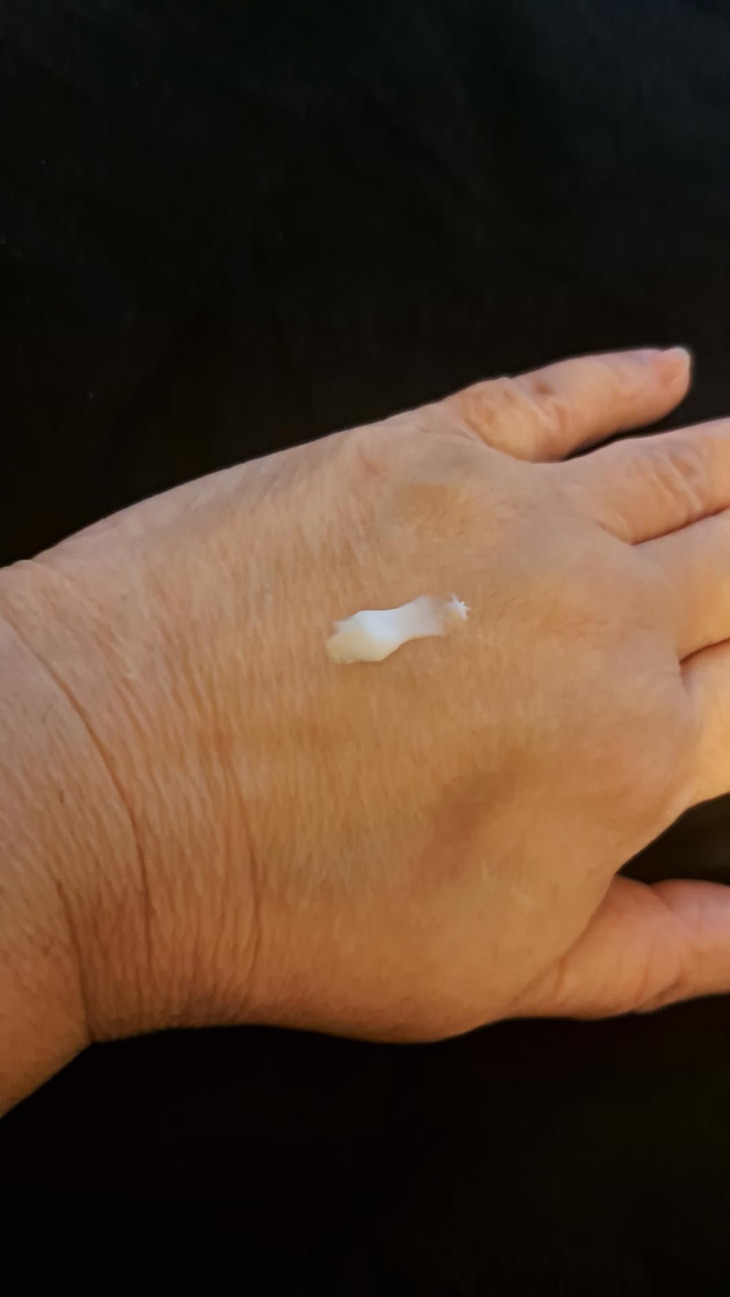 Miracle Foot Repair Cream, 4 oz Repairs Dry Cracked Heels and Feet, Diabetic-Safe, 60% Pure Ultra Aloe Moisturizes, Softens, and Repairs, Relief from Discomfort of Ingrown Toenails (2-Pack) customer photo 2