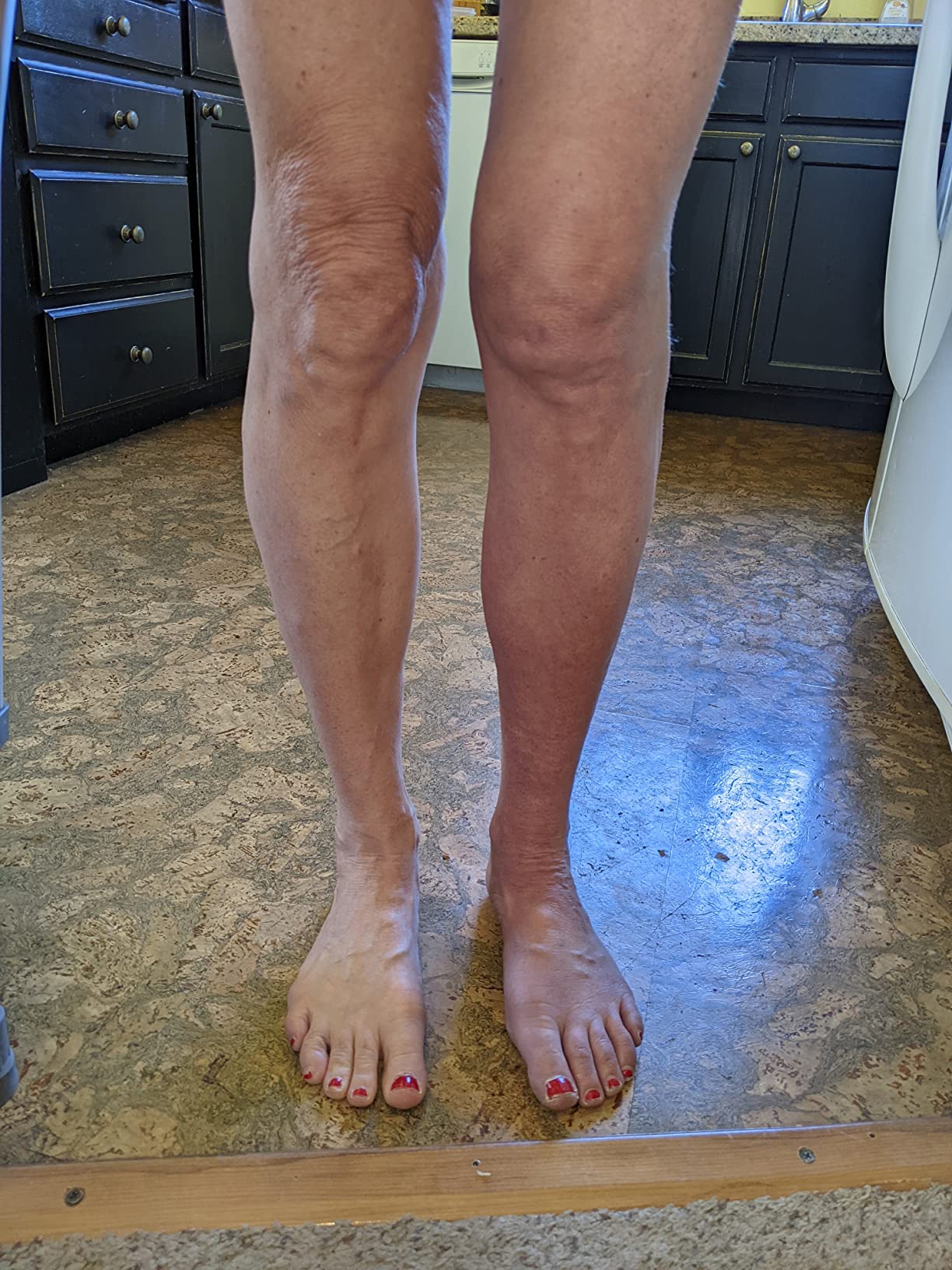 Therabody JetBoots Prime Wireless Compression Boots Leg Massager Recovery | Pneumatic Leg Compression for Circulation & Pain Relief, FDA Cleared, 4 Pressure Levels | Regular, 32-37in Leg Length customer photo 1