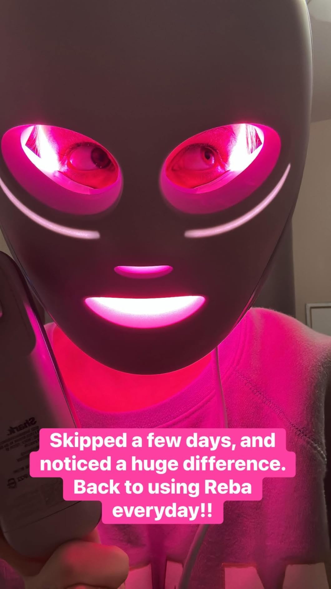 CryoGlow LED Face Mask with Under-Eye Cooling, Anti-Ageing & Blemish Repair, Red & Blue LED, Infrared Light Therapy, USB-C, Remote Control, Storage Bag, Blue Frost, FW312 customer photo 1