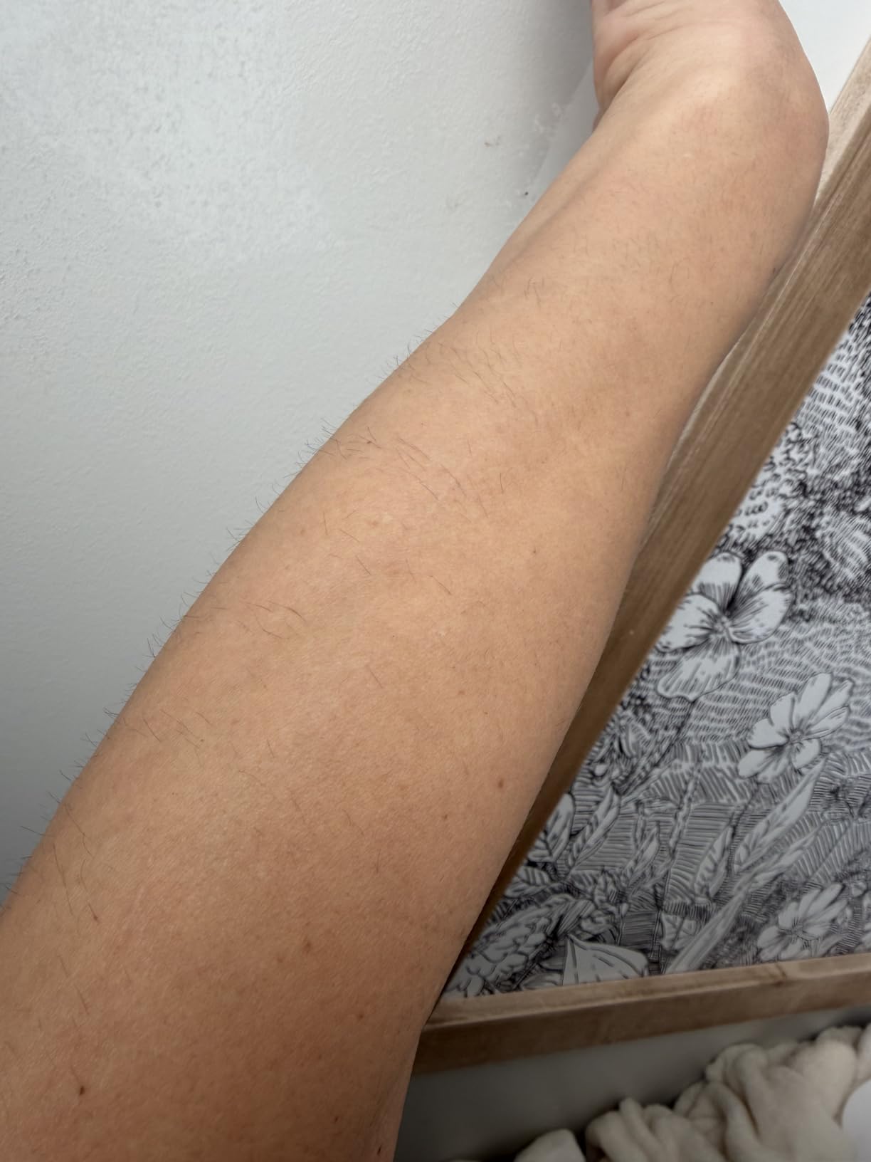 Nood Flasher Pro IPL Hair Removal customer photo 1