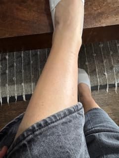 Nood Flasher Pro IPL Hair Removal customer photo 2