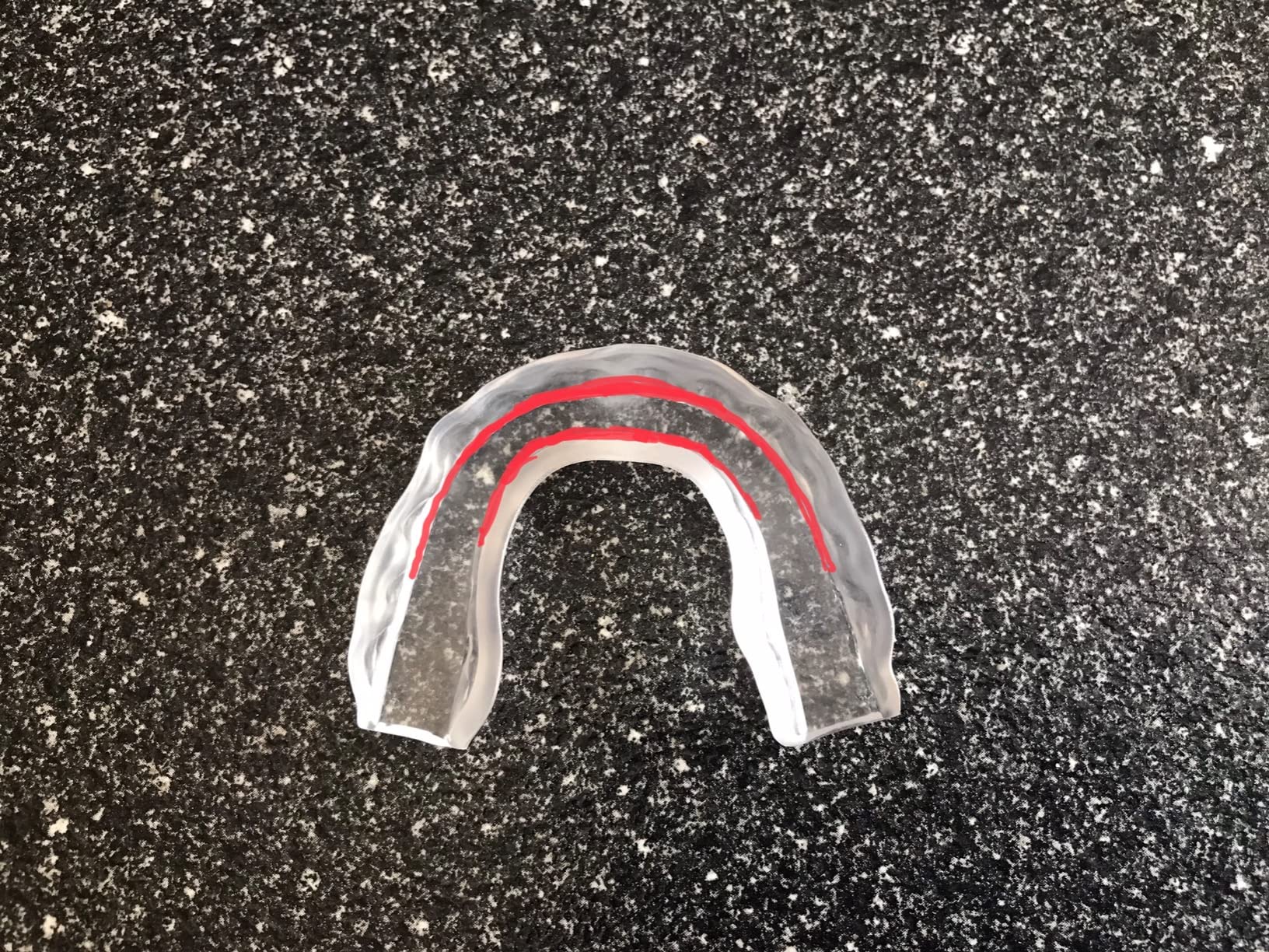 Teeth Whitening Pen Gel Kit: 35% Carbamide Peroxide Gel for Stain Removal - No Sensitivity with Remineralizing Pen for a Brighter Whiter Smile Mint (5 Pack) customer photo 1