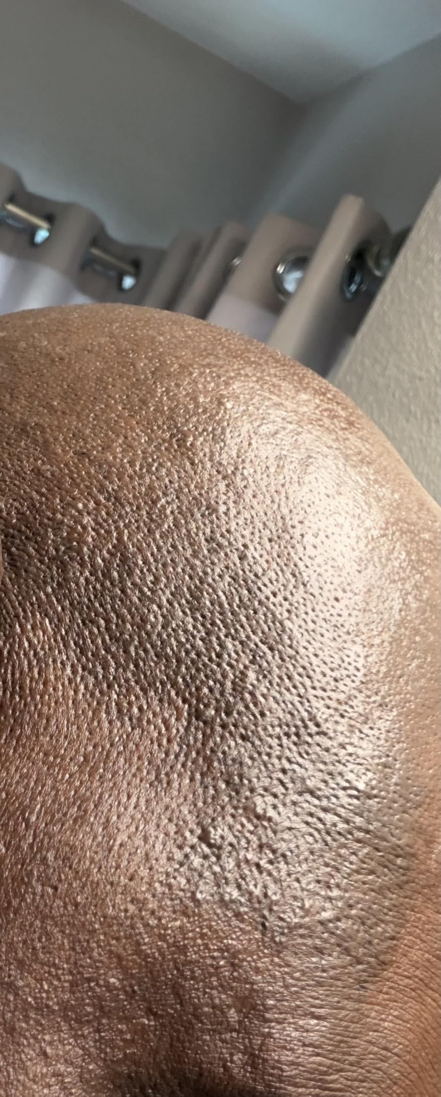 Philips Norelco Head Shaver Pro 7000 Series - Electric Shaver for Men and Women, 360° Flexing Head & ComfortCut Blades for Clean Shave, Gentle on Skin, Model HS7980/40 customer photo 1