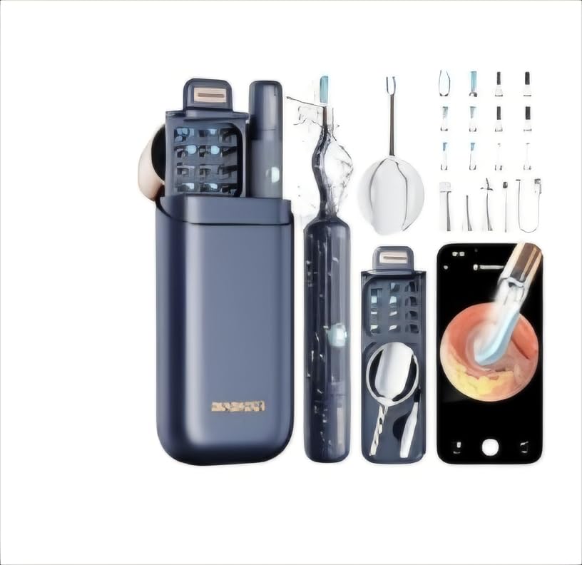 Ear Wax Removal Tool Camera: ZERONDER I35R Ear Cleaner with Flexible Ear Camera Otoscope - Visual Ear Pick Tweezers Wax Remover - Ear Cleaning Kit for Family customer photo 1