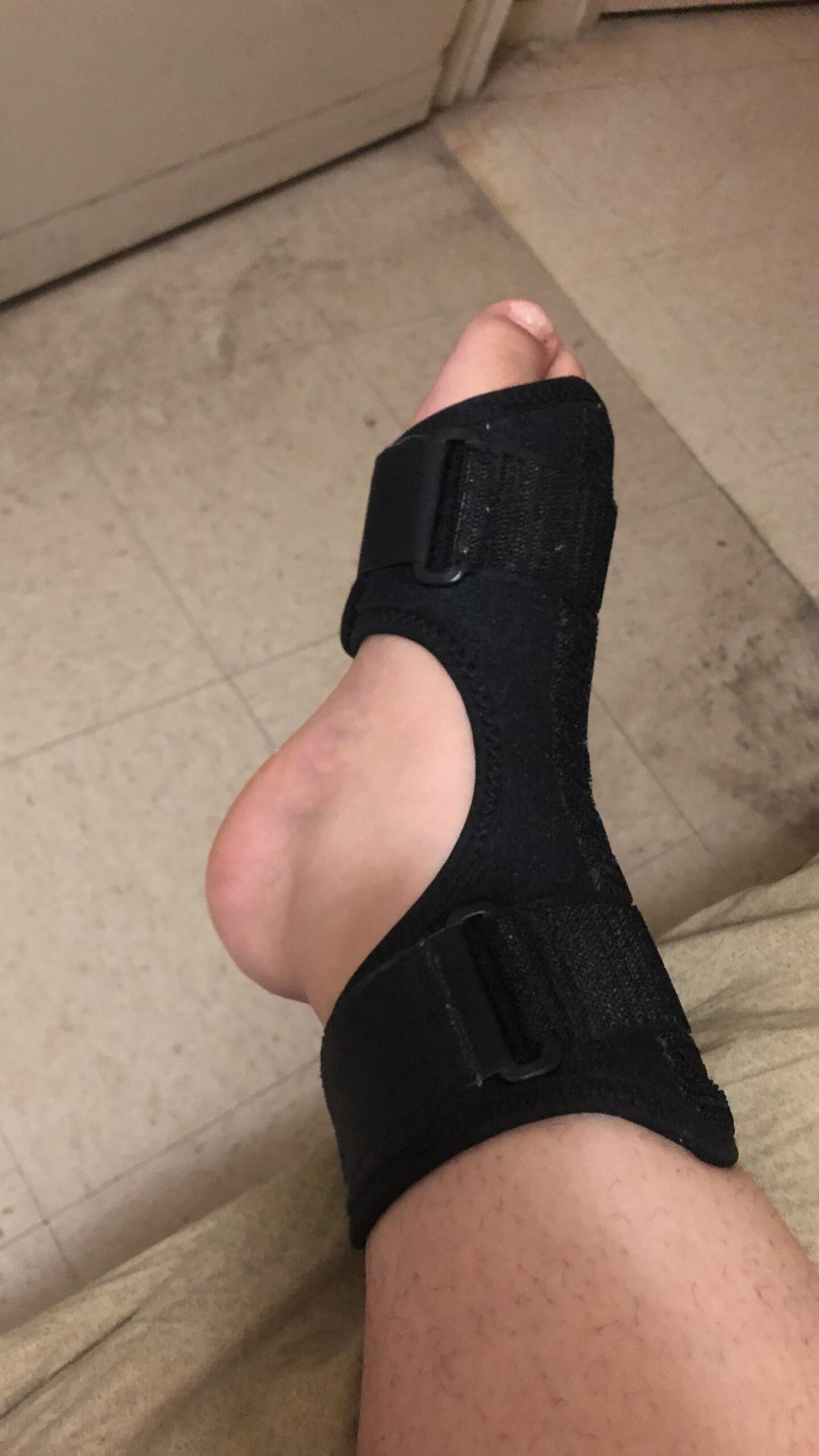 AZMED Plantar Fasciitis Night Splint & Support, Adjustable Orthotic Foot Drop Brace for Achilles Tendonitis and Heel Spur Relief, Black customer photo 2