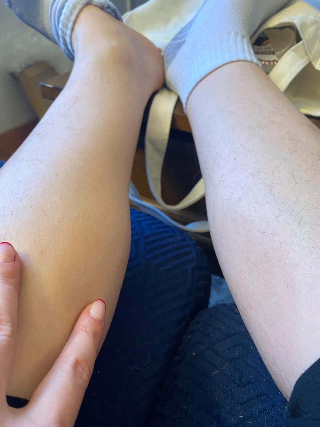 JOVS Laser Hair Removal IPL with Ice-Cooling customer photo 1