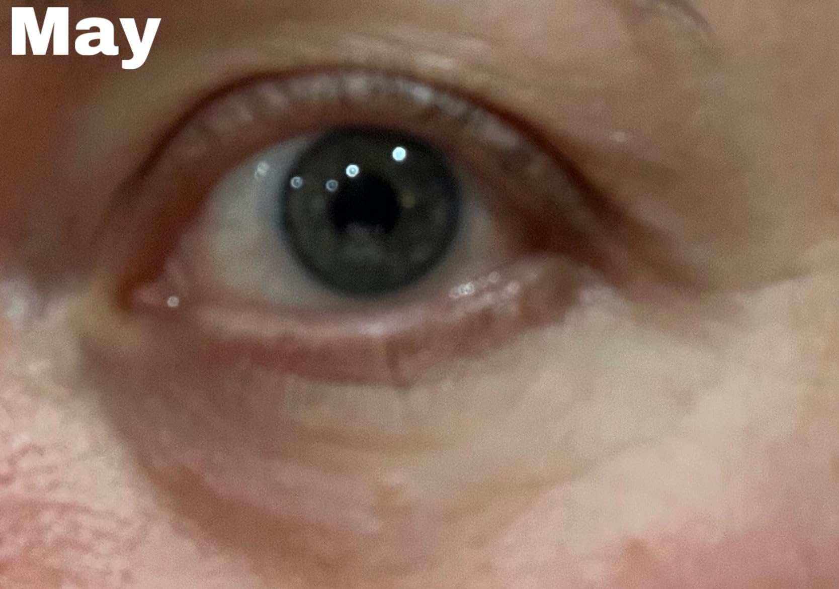 DRx SpectraLite Eyecare Max Pro customer photo 2