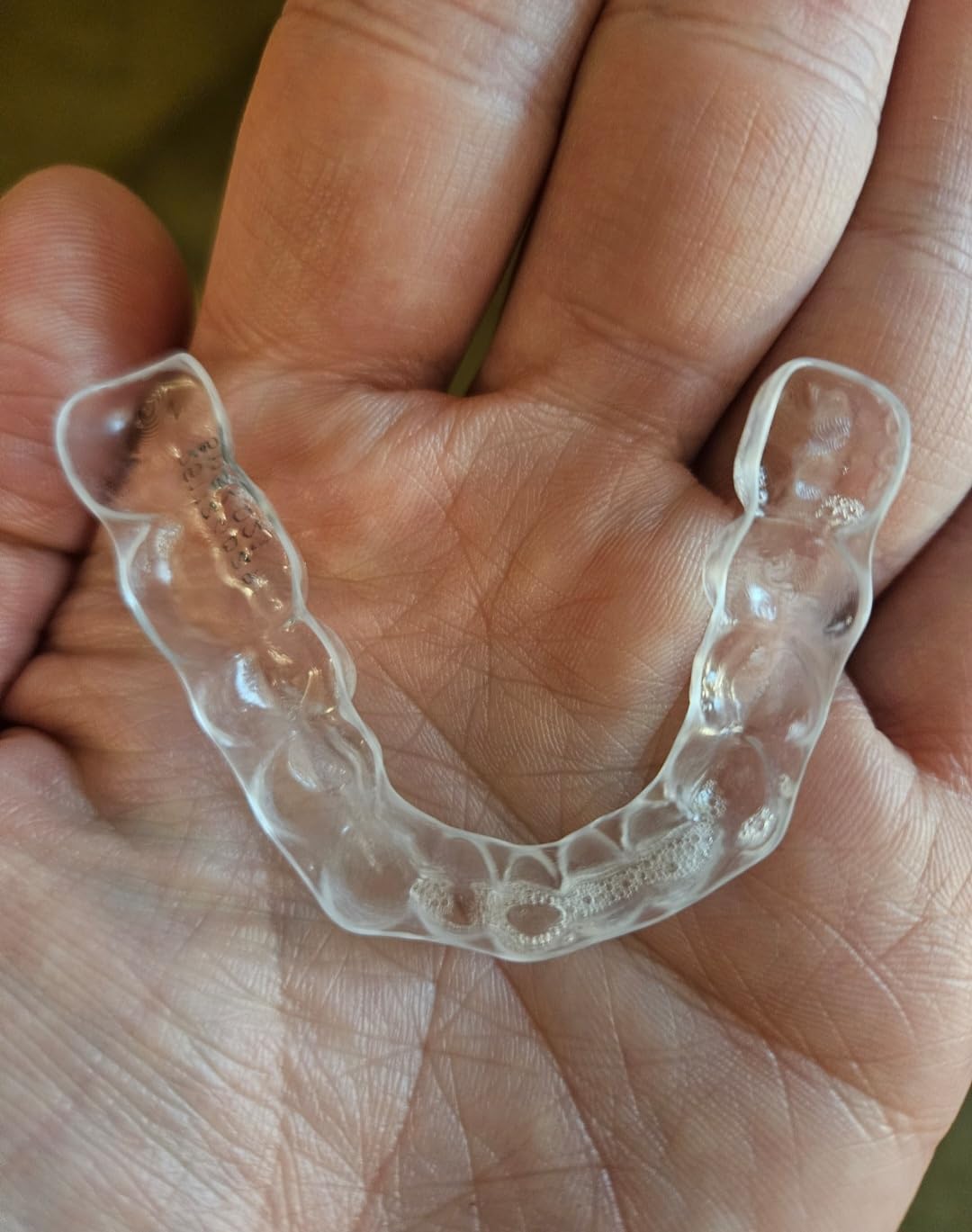 Custom Retainer, Clear Replacement Retainers for Teeth, BPA & Latex-Free, for Adults & Teens customer photo 2