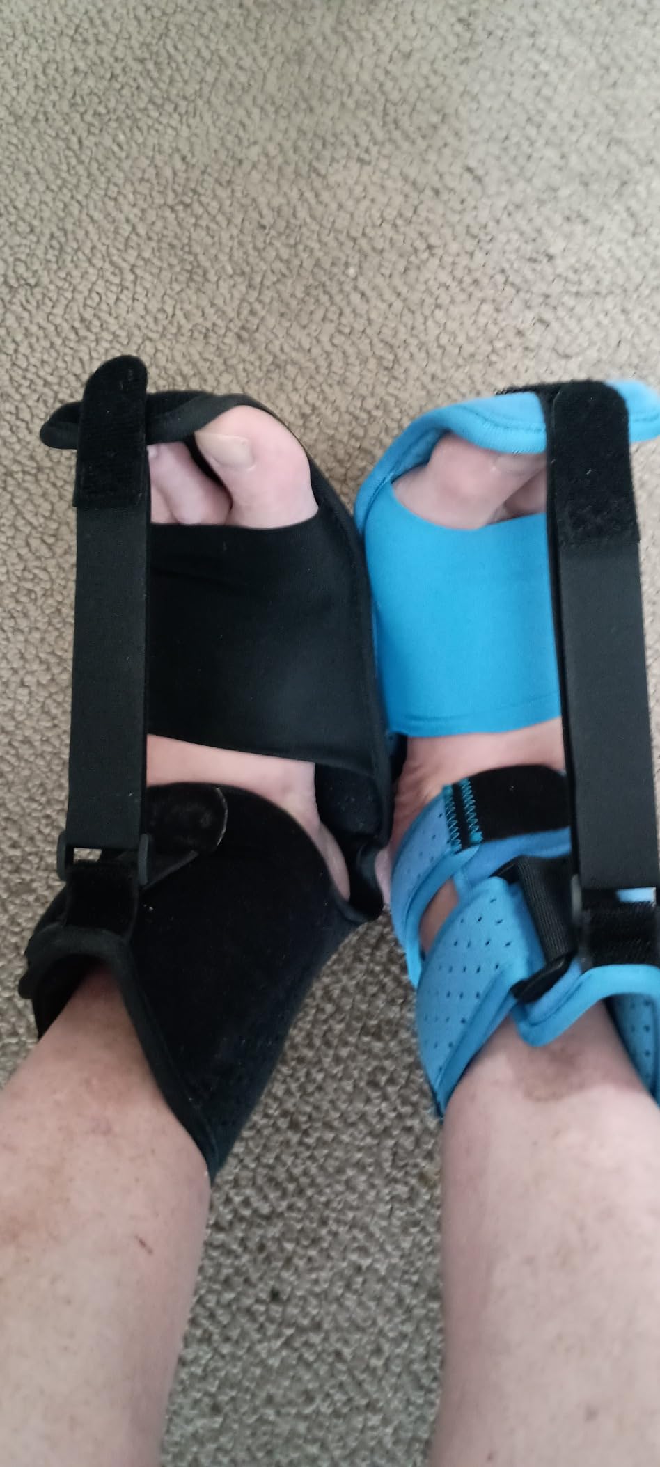 KTSAY Upgrade Plantar Fasciitis Night Splint & Relief Brace with Adjustable Straps - Support for Achilles Tendonitis, Heel Spur Pain, Day & Night Use (1, Blue) customer photo 1