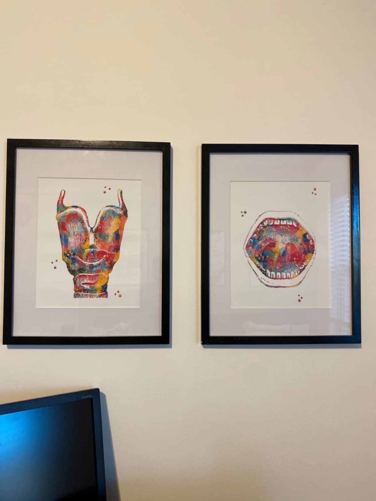 Watercolor Audiology Anatomy Illustration Art Print Set Featuring Cross Section Diagram for Audiology Office Decor, Otolaryngology Clinic Hearing Therapy Room Home Study Lab Wall Art, Med Student Audiologist Technician Nurse Doctor Graduation Gifts - 8x10 Unframed Print Set customer photo 1