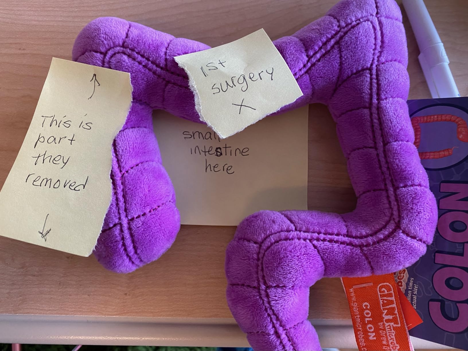 GIANT MICROBES Colon Plush, Funny Colonoscopy Gifts, Colon Cancer Awareness Items, Gastroenterology Gifts, Surgery Recovery Items, Colonoscopy Gift, Organ Plushies customer photo 2