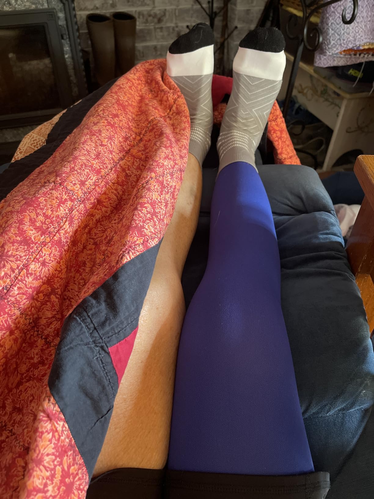 Doc Miller Thigh High Open Toe Compression Stockings 15-20mmHg for Varicose Veins, Pregnancy Support Open Toe Thigh High Compression Socks customer photo 2