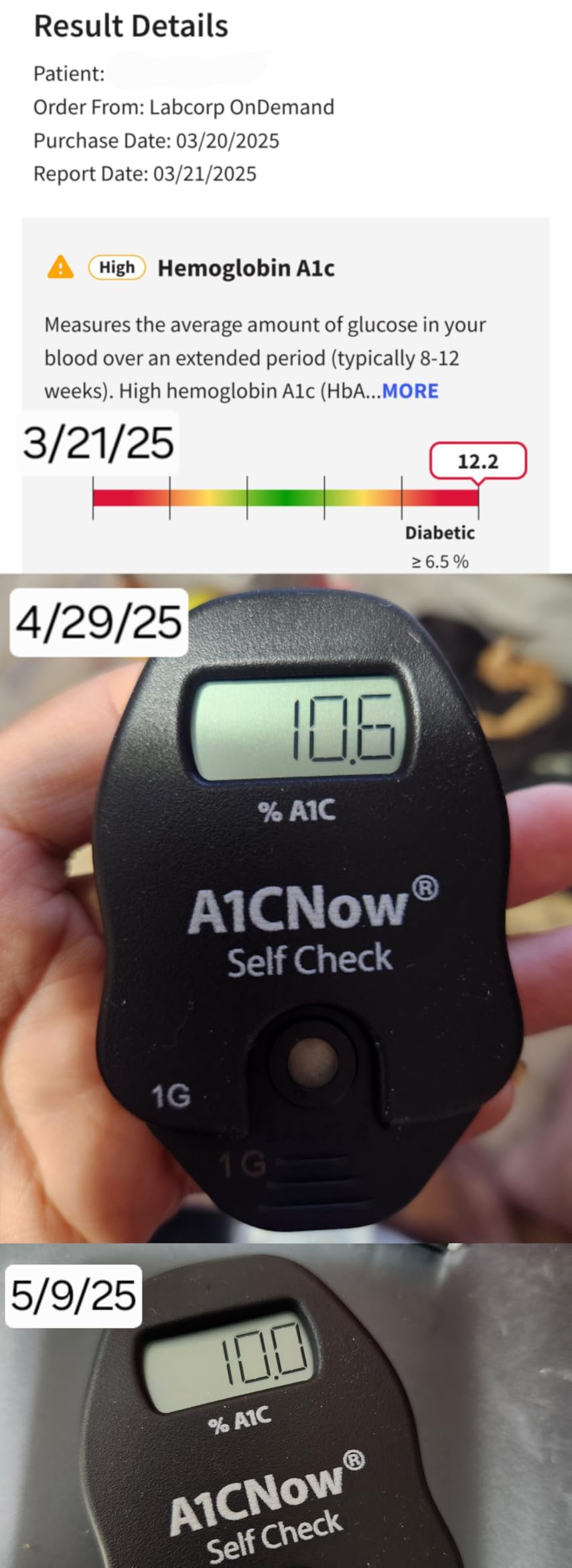 HSBHM-102 Home Care Portable Blood Hemoglobin Analyzer Anemia Hb Test Check Kit Handheld Finger Prick Meter Easy To Use Quick Results With 25Pcs Strips Lancets Droppers customer photo 1
