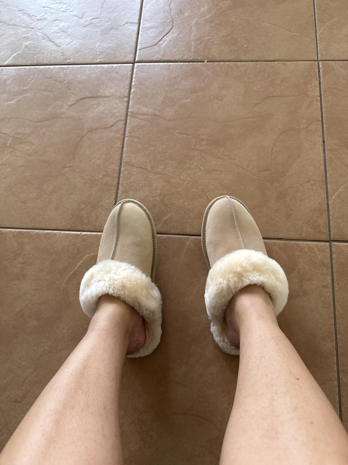 UGG Scuffette II customer photo 1