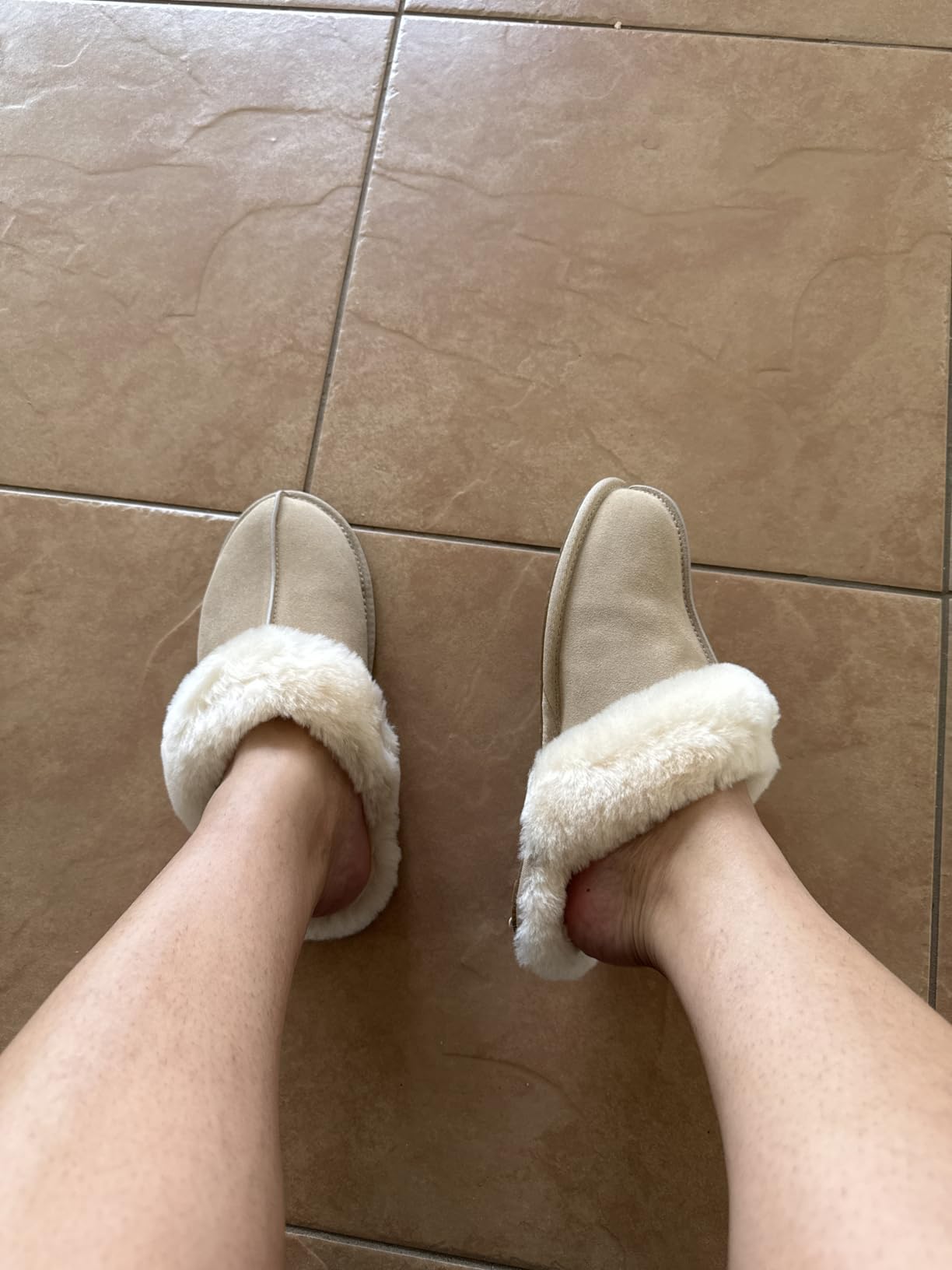 UGG Scuffette II customer photo 2
