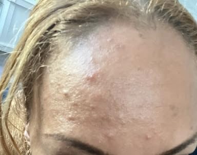 RoC Multi Correxion Revive + Glow Gel Vitamin C Cleanser, Face Wash, Facial Cleanser with Glycolic Acid, Paraben-Free, Sulfate-Free Skin Care, 6 Ounces customer photo 2